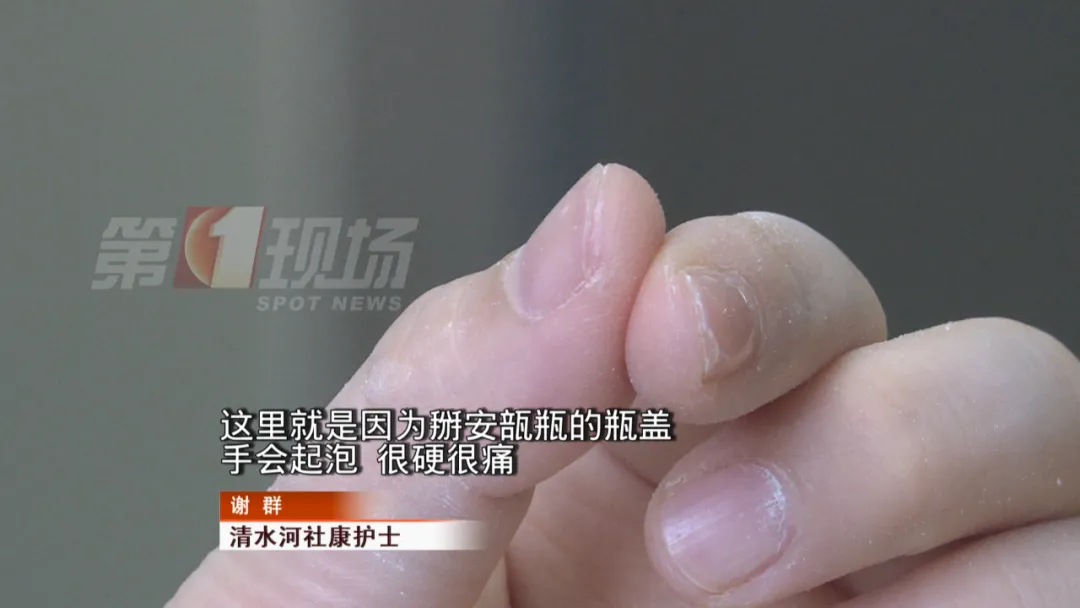 手指发泡脱皮1天接种500人，她们笑着说：开盖有茧！(图3)