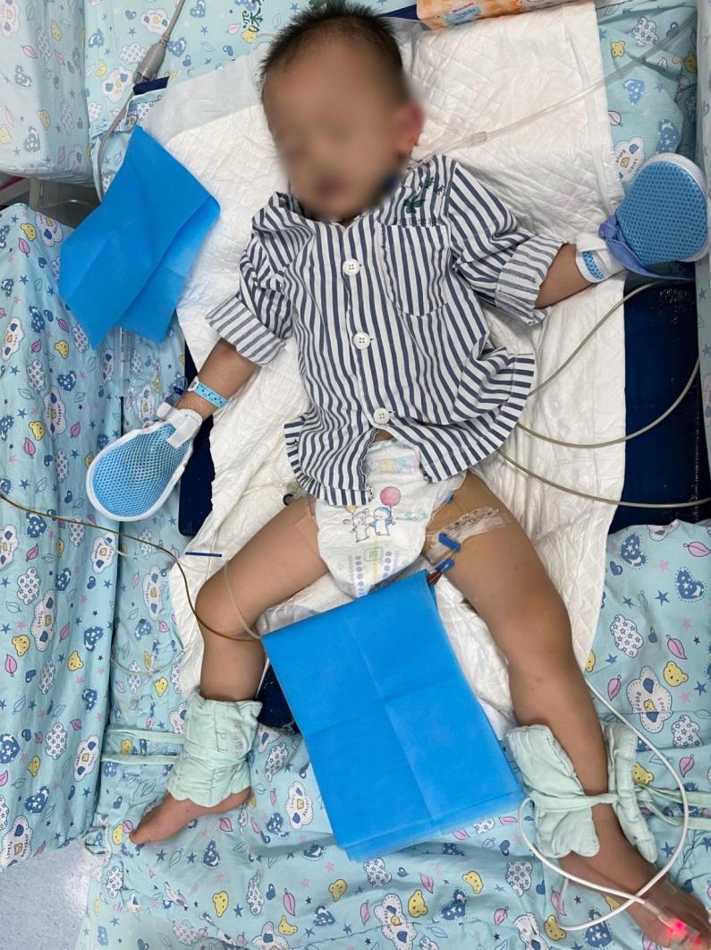 揪心！深圳一两岁娃往消毒片中倒水致急性氯气中毒，在PICU病房抢救8天…