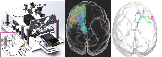 深圳科学家实现迄今最高精度猕猴大脑三维高清成像
