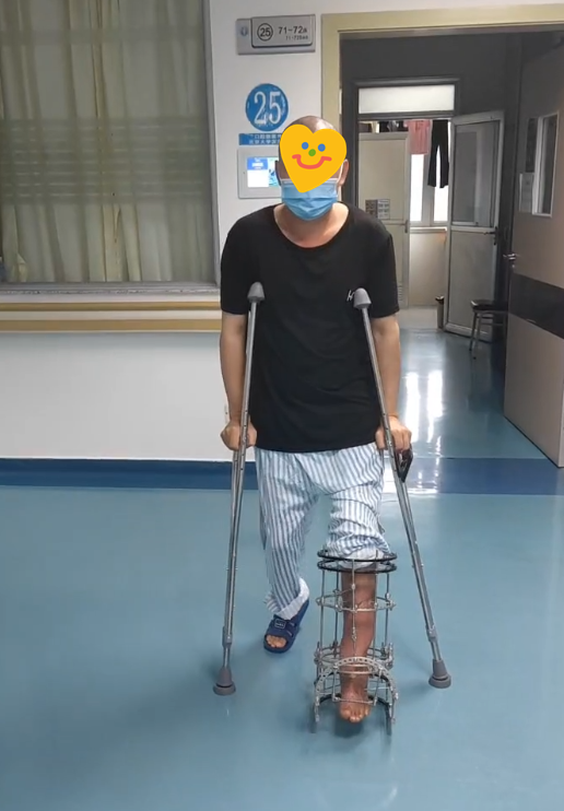 男子遇车祸下肢几乎离断 北大深圳医院创伤救治中心为其保肢保命