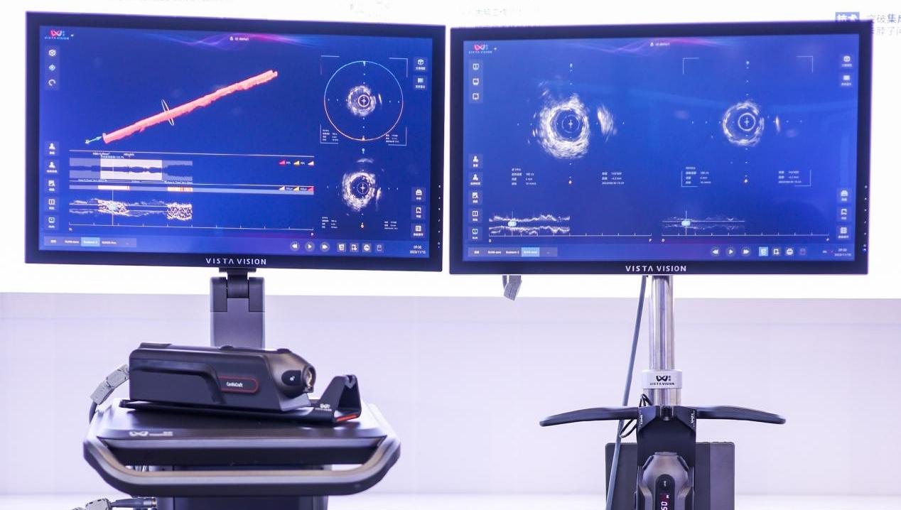 深圳科研团队成功研发最高频血管内超声成像系统