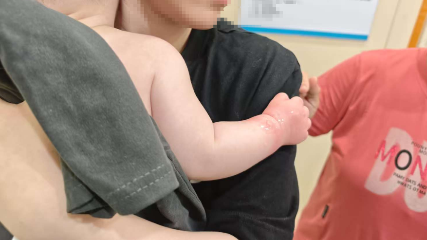 婴儿烫伤遇返程高峰 龙岗铁骑紧急送医