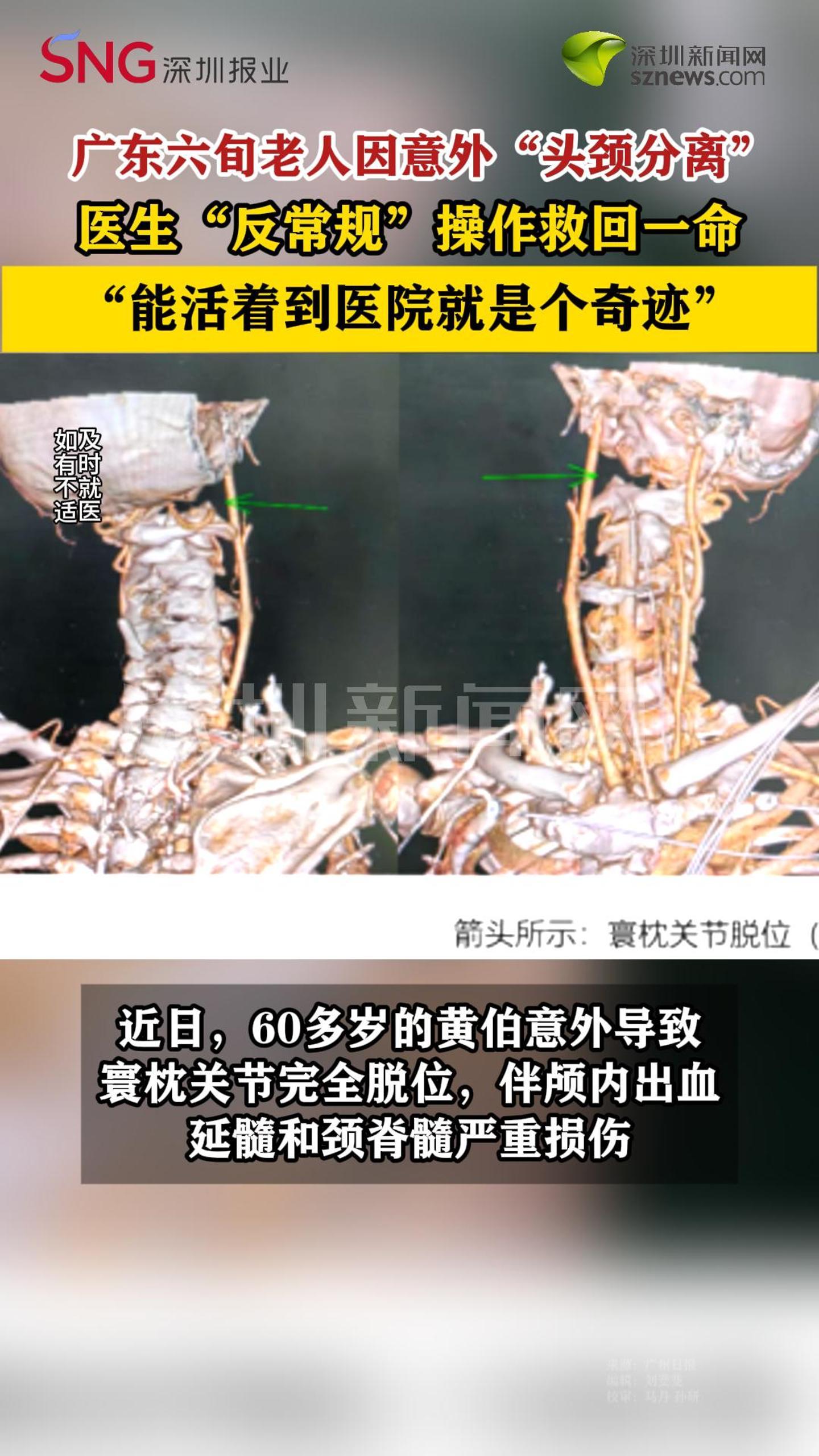 广东六旬老人因意外“头颈分离”被救回