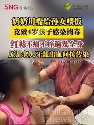 奶奶用嘴给孙女喂饭，竟致4岁孩子感染梅毒