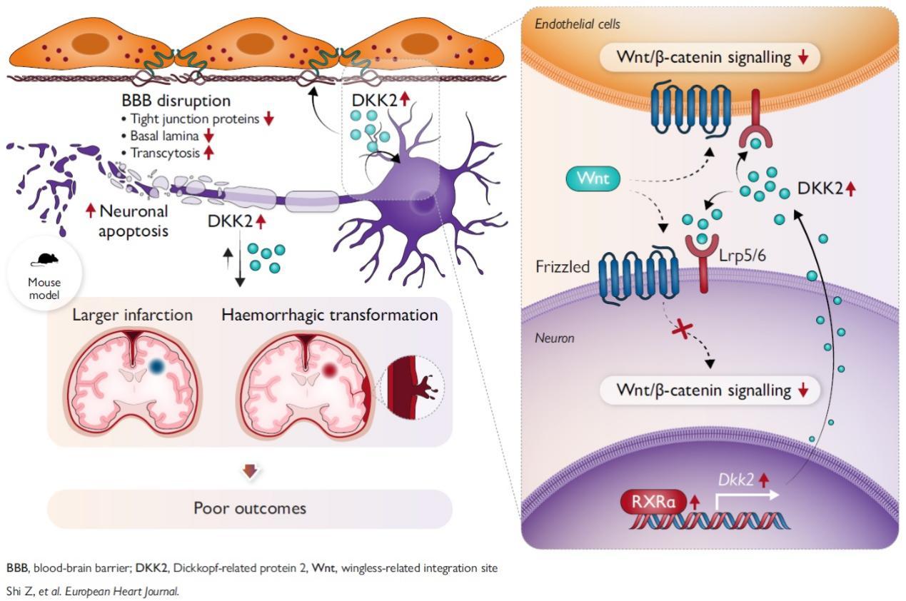 科学家找到神经血管损伤的“幕后推手”，有望成为脑梗治疗的新靶点