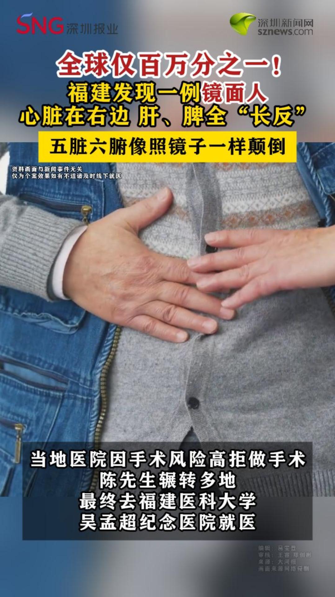福建发现一例镜面人 心脏在右边 肝、脾全“长反”