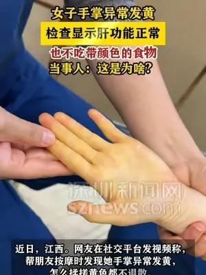 女子手掌异常发黄，检查显示肝功能正常，当事人：这是为啥？