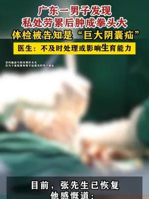 广东一男子发现私处劳累后肿成拳头大体检被告知是“巨大阴囊疝”
