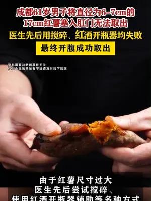成都一61岁男子将17cm红薯塞入体内 最终开腹成功取出