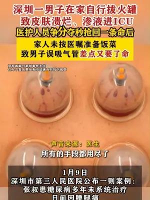 深圳一男子在家自行拔火罐致皮肤溃烂进ICU