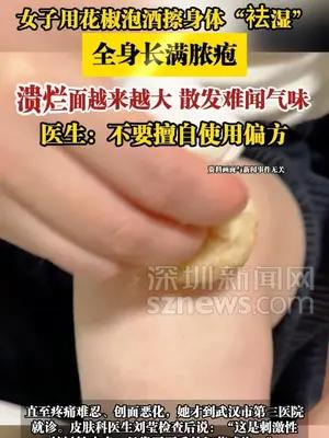 女子用花椒泡酒擦身体“袪湿”，全身长满脓疱