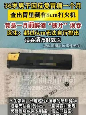 36岁男子醉酒“断片”误吞8cm打火机一个月