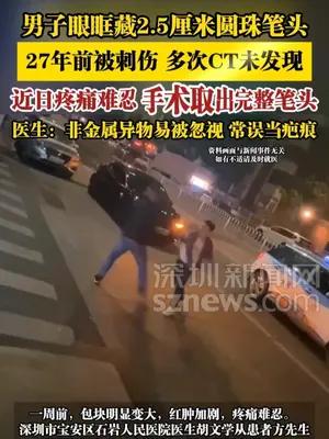 男子眼眶藏2.5厘米圆珠笔头，27年前被刺伤，多次CT未发现