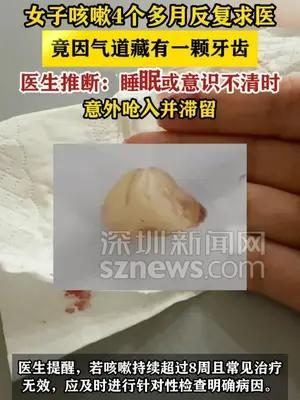 女子咳嗽4个多月元凶竟是一颗牙齿