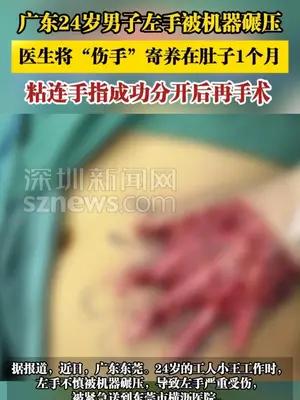广东24岁男子左手被机器碾压，医生将“伤手”寄养在肚子1个月