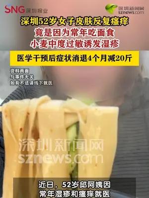 女子得湿疹老不好竟是因为常年吃面食