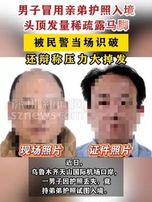 男子冒用亲弟护照因发量少露馅