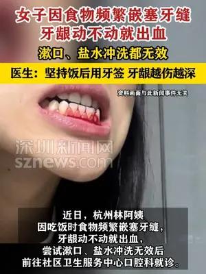 女子坚持饭后用牙签牙龈越伤越深