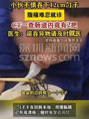 小伙腹痛CT查出肠道卡2把12cm勺子