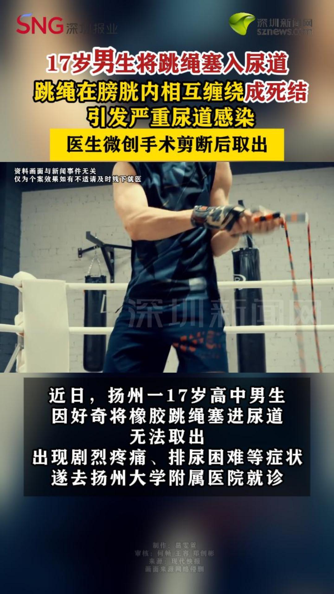 17岁男生将跳绳塞入尿道，跳绳在膀胱内相互缠绕成死结