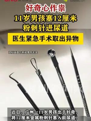 11岁男孩塞12厘米粉刺针进尿道