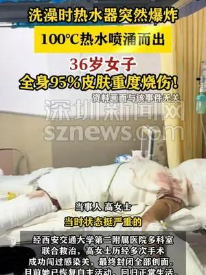 热水器爆炸致95%烫伤，女子历经多次手术终获新生