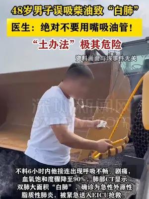 男子误吸柴油致“白肺” 医生：绝对不要用嘴吸油管