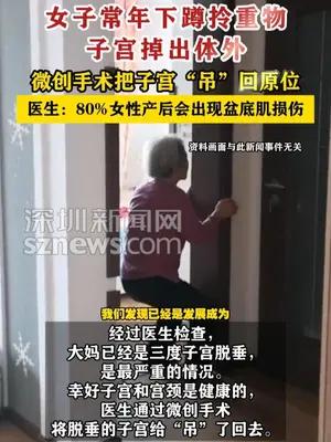 女子常年下蹲拎重物子宫掉出体外