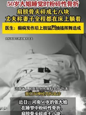 50岁大姐睡觉时粉碎性骨折