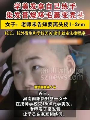 女子学美发在家拿自己练手中毒成秃头