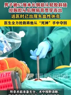 男子被67厘米长钢筋从屁股斜插贯穿至肩背