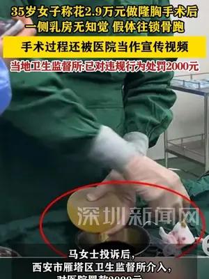 女子花2.9万隆胸致一侧乳房无知觉，假体往锁骨跑