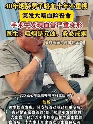 40年烟龄男子咯血十年不重视 突发咯血100mL险丧命
