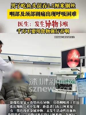 男子吃鱼头误吞2.5厘米钢丝，咽部及颈部剧痛出现呼吸困难