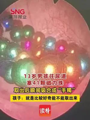 13岁男孩因好奇往尿道塞41颗磁力珠