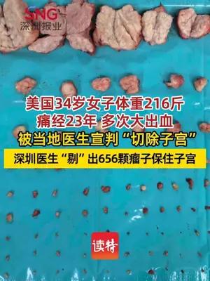 美国34岁女子痛经23年被当地医生宣判“切除子宫” 深圳医生“剔”出656颗瘤子保住子宫