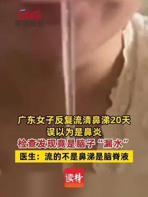 广东女子反复流清鼻涕20天检查发现脑子“漏水”
