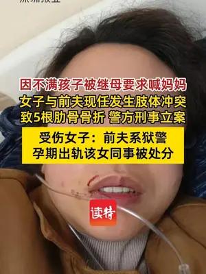 女子与前夫现任发生肢体冲突致5根肋骨骨折