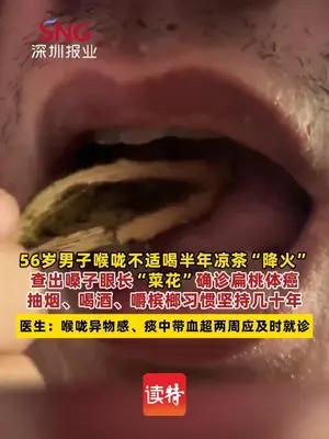 抽烟喝酒嚼槟榔，男子患上扁桃体癌