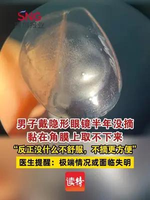 男子戴隐形眼镜半年没摘黏在角膜上取不下来