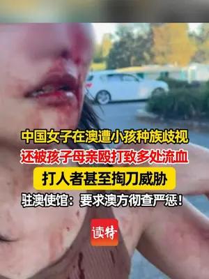 驻澳使馆回应中国女子在澳遭陌生人种族歧视、殴打