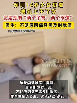 深圳14岁少女初潮剧痛被发现有“两个子宫、两个阴道”