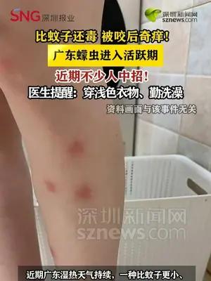 比蚊子还毒 被咬后奇痒！广东蠓虫进入活跃期