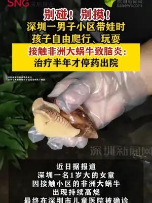 深圳一女童接触非洲大蜗牛致脑炎