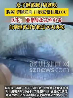 女子泡菜腌1周就吃，胸闷、手脚发麻、口唇发紫住进ICU