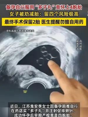 女子自行服用多子丸怀上4胞胎