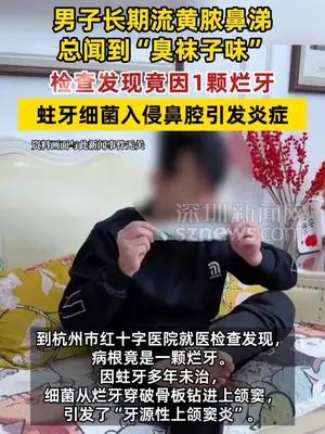 男子因蛀牙未治长期流黄脓鼻涕闻到“臭袜子味”