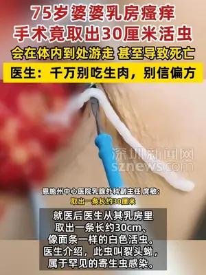 75岁阿姨从乳房取出30厘米长活虫