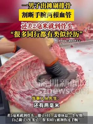 一男子出摊剔排骨割断手腕两根血管，还差2毫米就到骨头