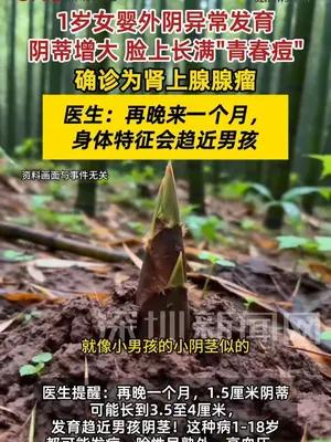 1岁女婴外阴异常发育险变男孩